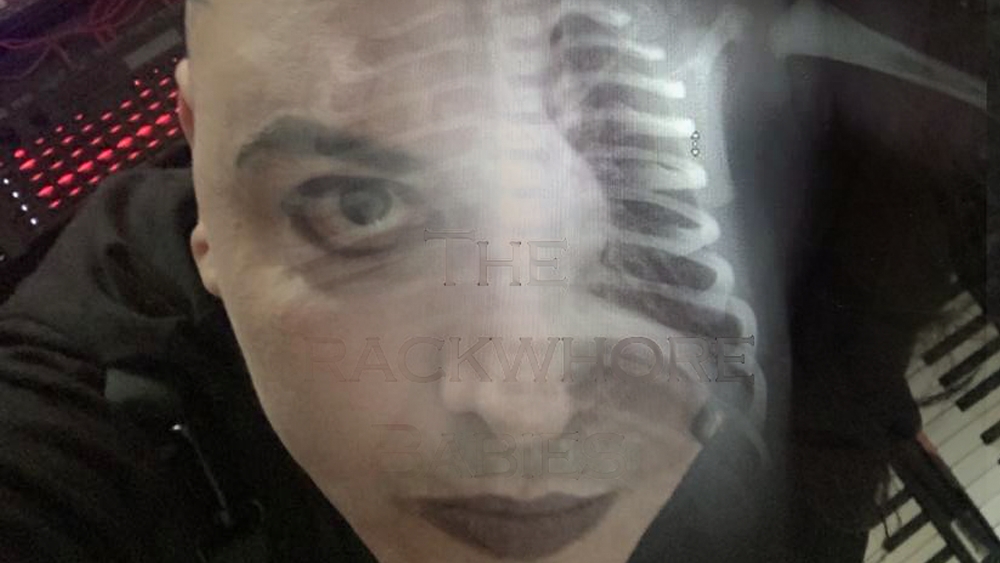 The Crackwhore Babies