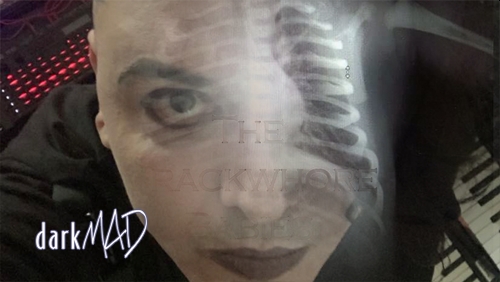 The Crackwhore Babies